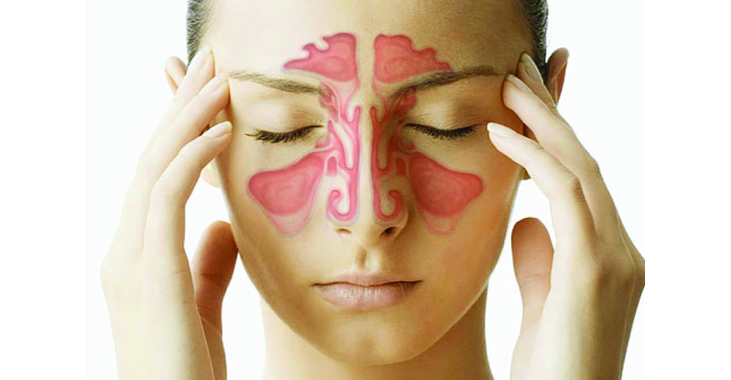 Nasal Congestion Causes Symptoms And Treatment